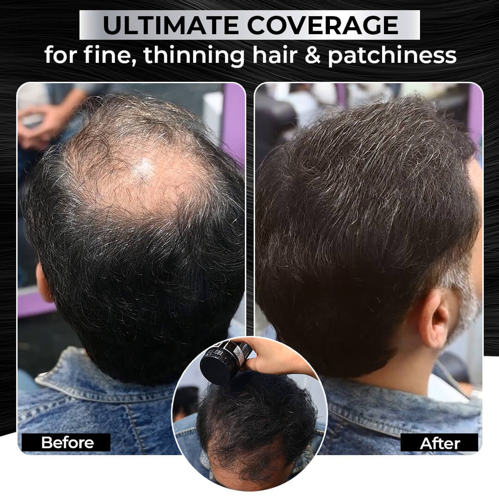 Before and after comparison of hair thinning and patchiness with a hair product application.